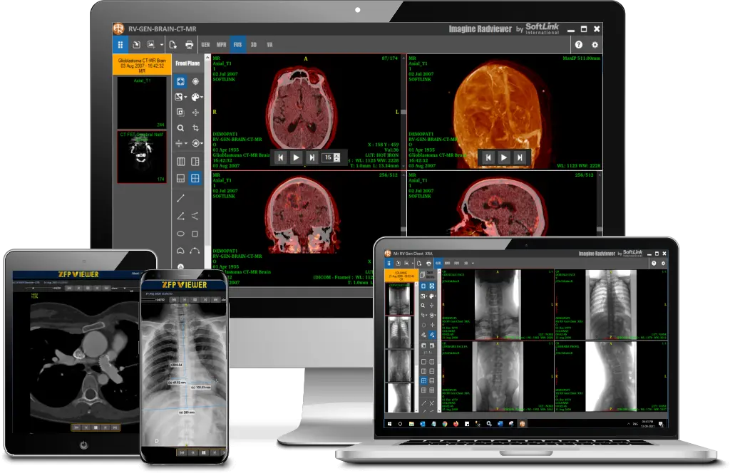 PACS Radiology Software | PACS System Radiology Cost functionality