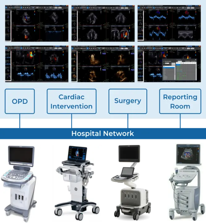Echo PACS Echocardiography PACS ge EchoPAC System Benefits